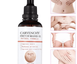 Carvanchey Strech Mark Oil Price In Pakistan | Wellmart  +923208727951