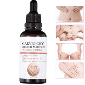 Carvanchey Strech Mark Oil Price In Pakistan | Wellmart  +923208727951