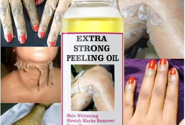 Extra Strong Peeling Oil In Pakistan Wellmart +923208727951