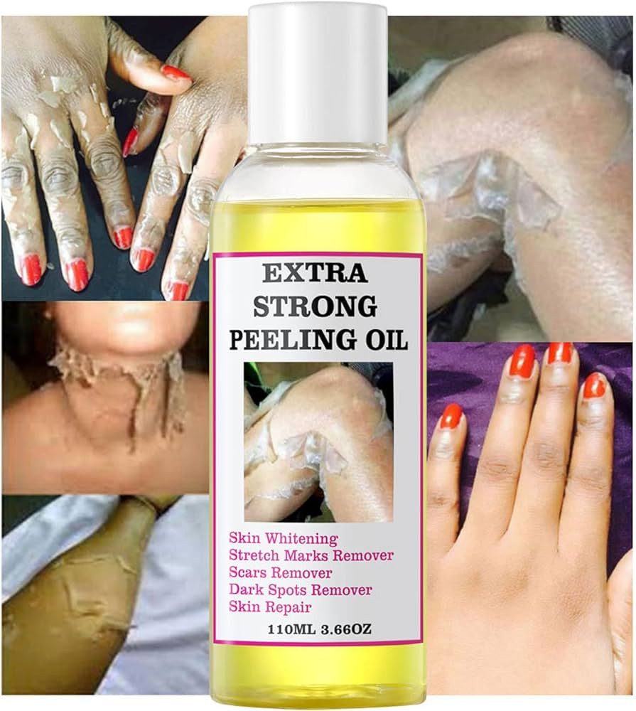 Extra Strong Peeling Oil In Pakistan Wellmart +923208727951