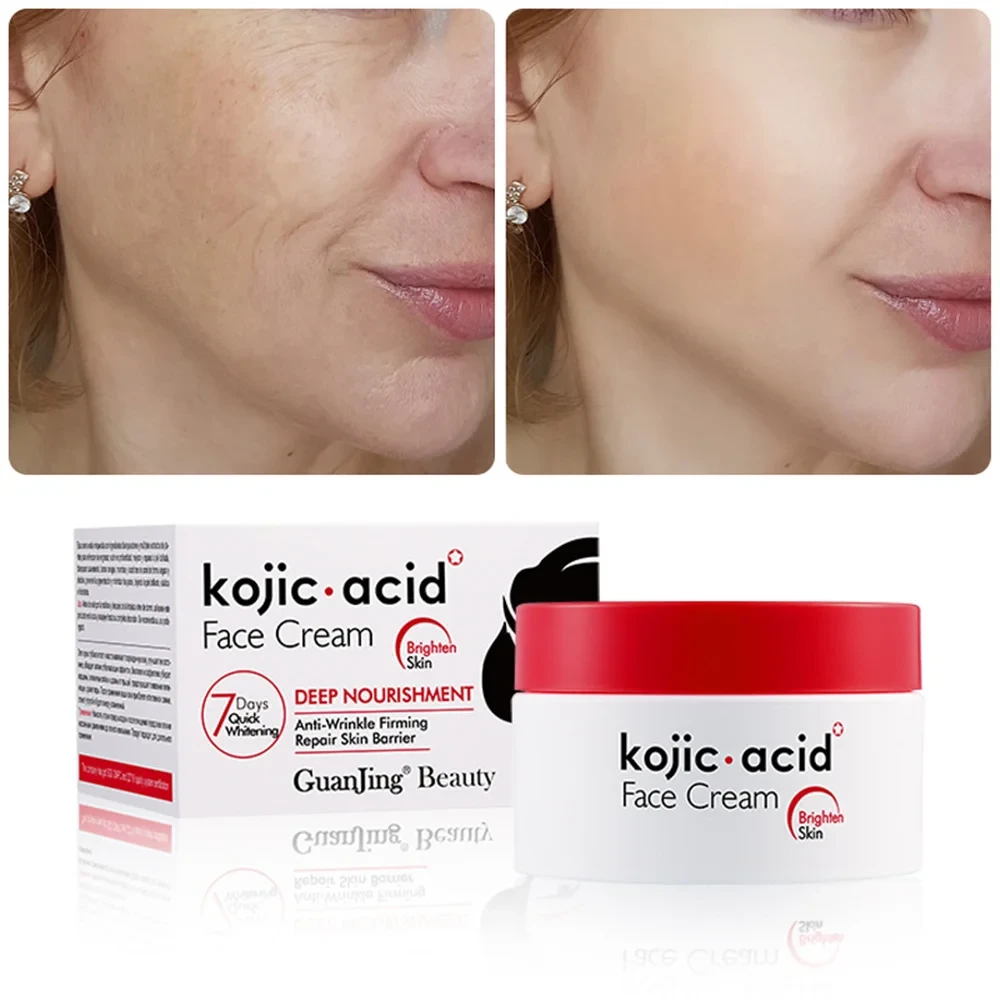 Kojic Acid Face Cream In Pakistan Wellmart +923208727951