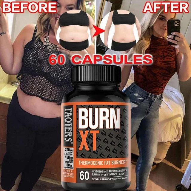 Taoters Burn XT Weight Loss Capsules Price In Pakistan Wellmart +923208727951