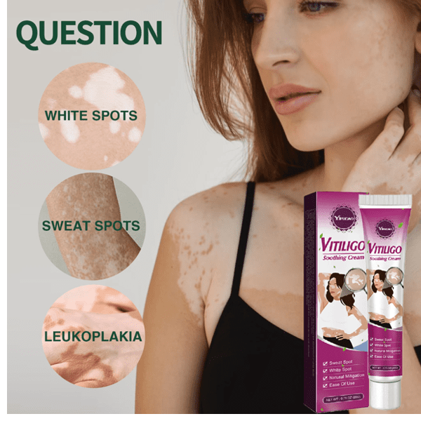 Yifucao Vitiligo Soothing Cream Price In Pakistan Wellmart +923208727951